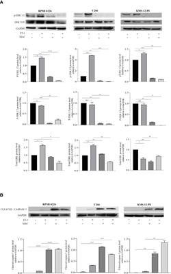 Targeting the Endothelin-1 Receptors Curtails Tumor Growth and Angiogenesis in Multiple Myeloma